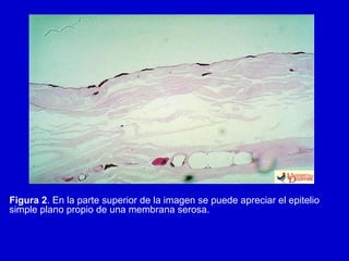 Figura 2. En la parte superior de la imagen se puede apreciar el epitelio
simple plano propio de una membrana serosa.
 