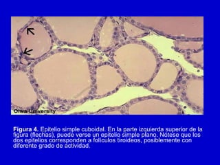 Figura 4. Epitelio simple cuboidal. En la parte izquierda superior de la
figura (flechas), puede verse un epitelio simple plano. Nótese que los
dos epitelios corresponden a folículos tiroideos, posiblemente con
diferente grado de actividad.
 