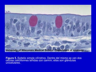 Figura 5. Epitelio simple cilíndrico. Dentro del mismo se ven dos
células caliciformes teñidas con carmín; ellas son glándulas
unicelulares.
 