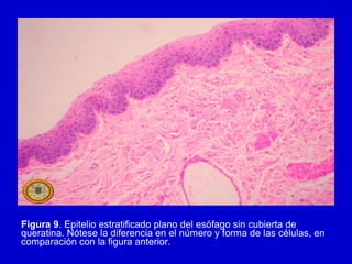 Figura 9. Epitelio estratificado plano del esófago sin cubierta de
queratina. Nótese la diferencia en el número y forma de las células, en
comparación con la figura anterior.
 