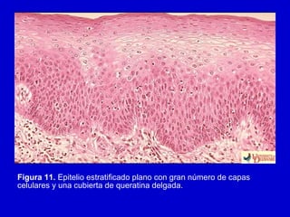 Figura 11. Epitelio estratificado plano con gran número de capas
celulares y una cubierta de queratina delgada.
 