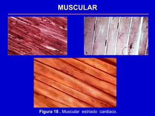 MUSCULAR
Figura 18 . Muscular estriado cardiaco.
 