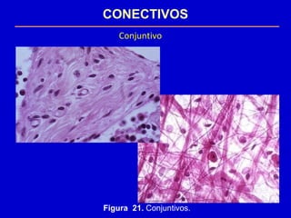 CONECTIVOS
Conjuntivo
Figura 21. Conjuntivos.
 