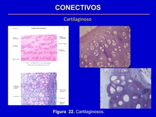 CONECTIVOS
Cartilaginoso
Figura 22. Cartilaginosos.
 