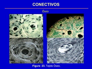 CONECTIVOS
Óseo
Figura 23. Tejido Óseo.
 