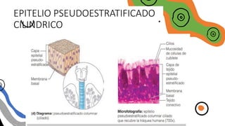 EPITELIO PSEUDOESTRATIFICADO
CILINDRICO
 