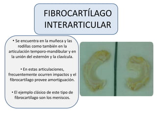 FIBROCARTÍLAGO
INTERARTICULAR
• Se encuentra en la muñeca y las
rodillas como también en la
articulación temporo-mandibular y en
la unión del esternón y la clavícula.
• En estas articulaciones,
frecuentemente ocurren impactos y el
fibrocartílago provee amortiguación.
• El ejemplo clásico de este tipo de
fibrocartílago son los meniscos.
 
