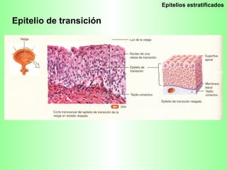 Epitelios estratificados Epitelio de transición  