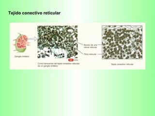 Tejido conectivo reticular 