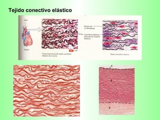 Tejido conectivo elástico 