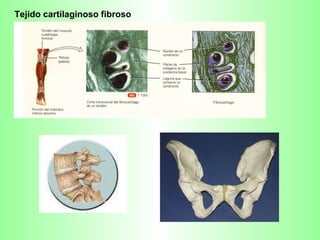 Tejido cartilaginoso fibroso 