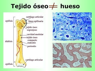 Tejido óseo  hueso 