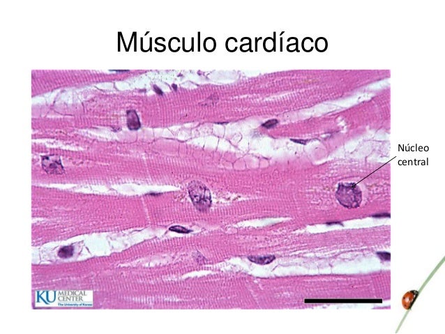Musculo Cardiaco Corte Transversal Y Longitudinal es.slideshare.net