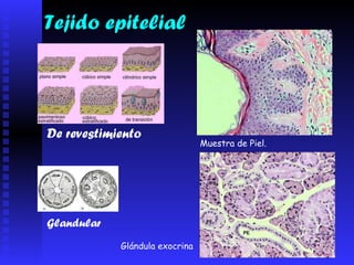 Tejido epitelial Muestra de Piel.  Glándula exocrina De revestimiento Glandular 