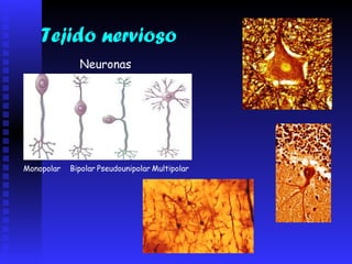 Tejido nervioso Neuronas Monopolar Bipolar Pseudounipolar Multipolar 