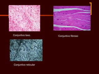Conjuntivo laxo.       Conjuntivo fibroso




Conjuntivo reticular
 