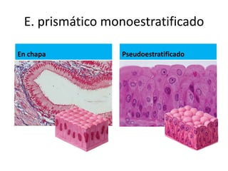 E. prismático monoestratificado

En chapa         Pseudoestratificado
 