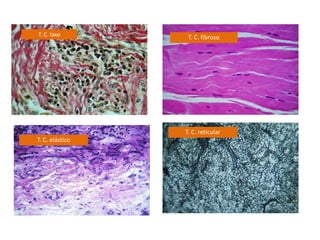 T. C. laxo        T. C. fibroso




                 T. C. reticular
T. C. elástico
 