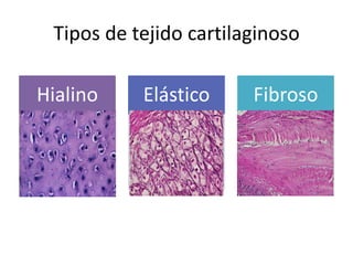 Tipos de tejido cartilaginoso

Hialino    Elástico     Fibroso
 