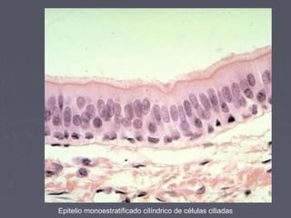 Epitelio monoestratificado cilíndrico de células ciliadas
 