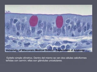 Epitelio simple cilíndrico. Dentro del mismo se ven dos células caliciformes
teñidas con carmín; ellas son glándulas unicelulares.
 