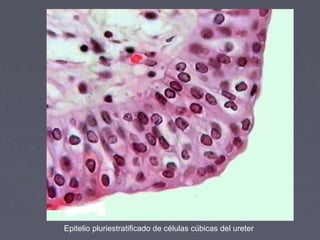 Epitelio pluriestratificado de células cúbicas del ureter
 