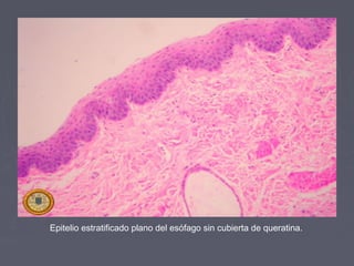 Epitelio estratificado plano del esófago sin cubierta de queratina.
 