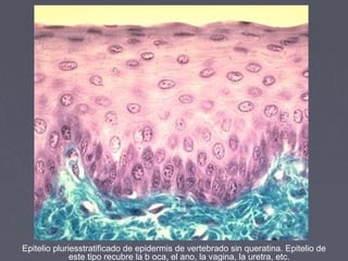 Epitelio pluriesstratificado de epidermis de vertebrado sin queratina. Epitelio de
              este tipo recubre la b oca, el ano, la vagina, la uretra, etc.
 