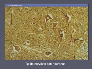 Tejido nervioso con neuronas
 