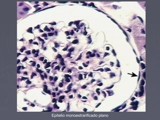Epitelio monoestrarificado plano
 