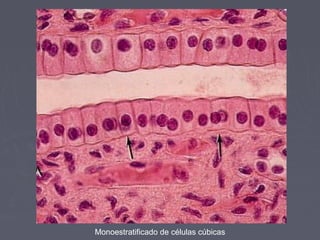 Monoestratificado de células cúbicas
 