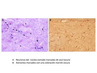 A. Neuronas del núcleo estriado marcadas de azul oscuro
B. Astrocitos marcados con una coloración marrón oscura

 
