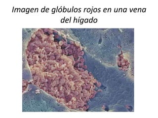 Imagen de glóbulos rojos en una vena
del hígado

 