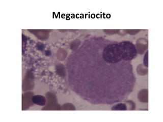 Megacariocito

 