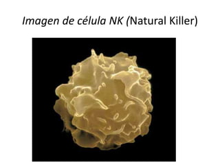 Imagen de célula NK (Natural Killer)

 