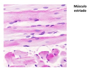 Músculo
estriado

Toda
s las
marc
as
Ning
una
marc
a

 