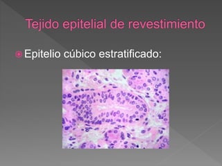  Epitelio cúbico estratificado:
 