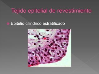  Epitelio cilindrico estratificado
 