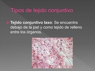  Tejido conjuntivo laxo: Se encuentra
debajo de la piel y como tejido de relleno
entre los órganos.
 