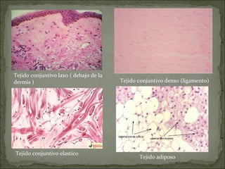 Tejido adiposo
Tejido conjuntivo denso (ligamento)
Tejido conjuntivo laxo ( debajo de la
dermis )
Tejido conjuntivo elastico
 