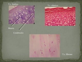 Matriz
Condrocito
T.c. hialino
T.c. elástico
T.c. fibroso
 