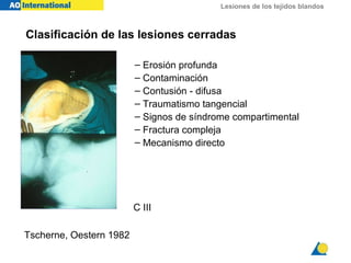 Lesiones de los tejidos blandos
– Erosión profunda
– Contaminación
– Contusión - difusa
– Traumatismo tangencial
– Signos de síndrome compartimental
– Fractura compleja
– Mecanismo directo
C III
Tscherne, Oestern 1982
Clasificación de las lesiones cerradas
 