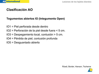 Lesiones de los tejidos blandos
Tegumentos abiertos IO (Integuments Open)
IO1 = Piel perforada desde dentro
IO2 = Perforación de la piel desde fuera < 5 cm.
IO3 = Despegamiento local, contusión > 5 cm.
IO4 = Pérdida de piel, contusión profunda
IO5 = Desguantado abierto
Rüedi, Border, Hanson, Tscherne
Clasificación AO
 
