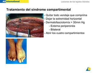 Lesiones de los tejidos blandos
Tratamiento del síndrome compartimental
- Quitar todo vendaje que comprima
- Dejar la extremidad horizontal
- Dermatofasciotomía > 30mm Hg
- Externa periperonéa
- Bilateral
- Abrir los cuatro compartimientos
 