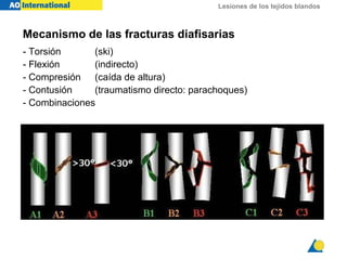 Lesiones de los tejidos blandos
Mecanismo de las fracturas diafisarias
- Torsión (ski)
- Flexión (indirecto)
- Compresión (caída de altura)
- Contusión (traumatismo directo: parachoques)
- Combinaciones
 