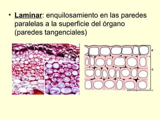 • Laminar: enquilosamiento en las paredes
paralelas a la superficie del órgano
(paredes tangenciales)

 