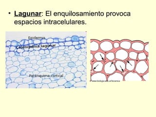 • Lagunar: El enquilosamiento provoca
espacios intracelulares.

 