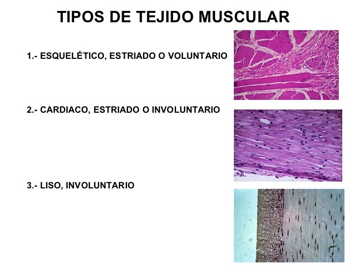 Resultado de imagen para tejido muscular de tipo estriado esquelético
