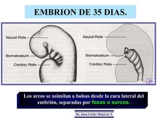 Dr. Juan Carlos Munévar N
EMBRION DE 35 DIAS.
Los arcos se asimilan a bolsas desde la cara lateral del
embrión, separadas ...