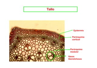 Tallo




             Epidermis


           Parénquima
           cortical



         Parénquima
         medular

        Vasos
        liberoleñosos
 